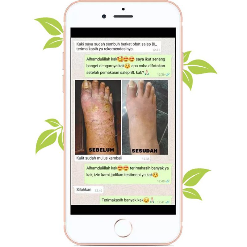 saleb BL original 100% asli salep gatal gatel selangkangan eksim kering paling manjur-4