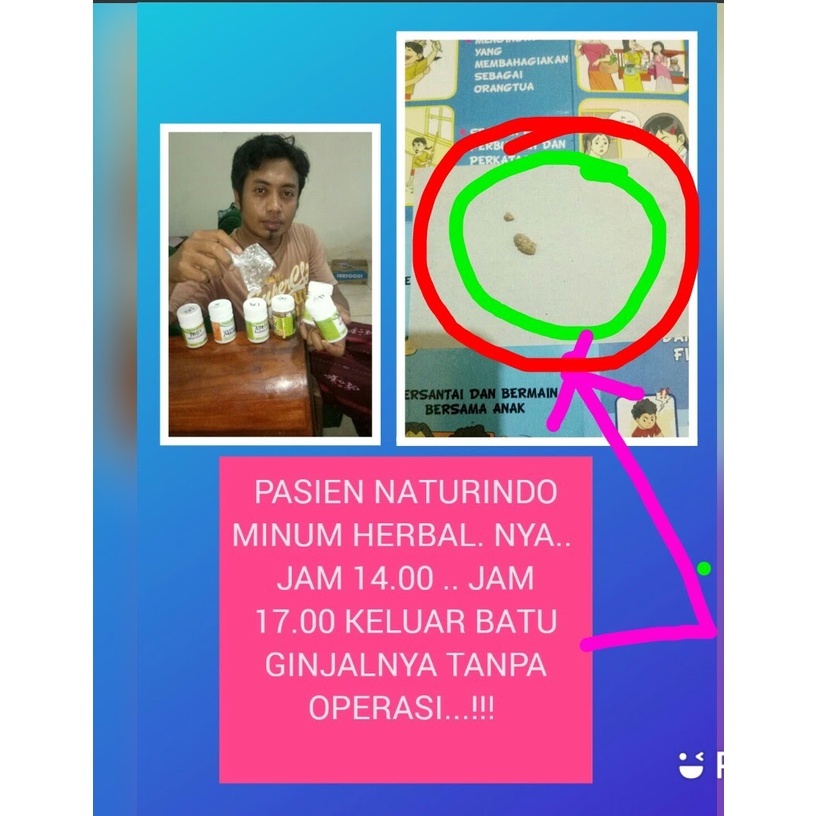 Image of Obat Kencing Batu Ginjal Yang Ampuh Tanpa Operasi Dan pinggang Sakit Herbal Bpom #1