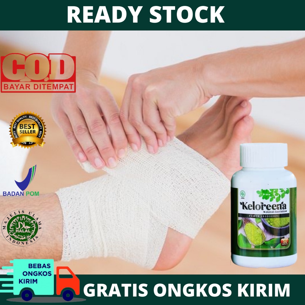 Obat Kaki Keseleo, Terkilir Bengkak, Kaki Bengkak Terbentur, Kaki Bengkak Sebelah, Kaki Sakit Terasa