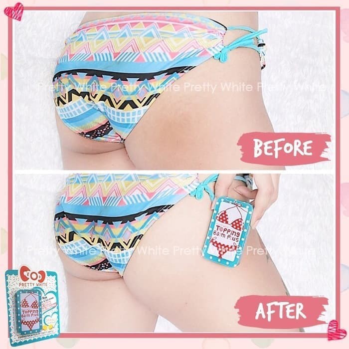 Topping Balm Pemutih Selangkangan Ketiak Bokong Pantat BPOM