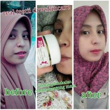 KRIM MATA DRW SKINCARE