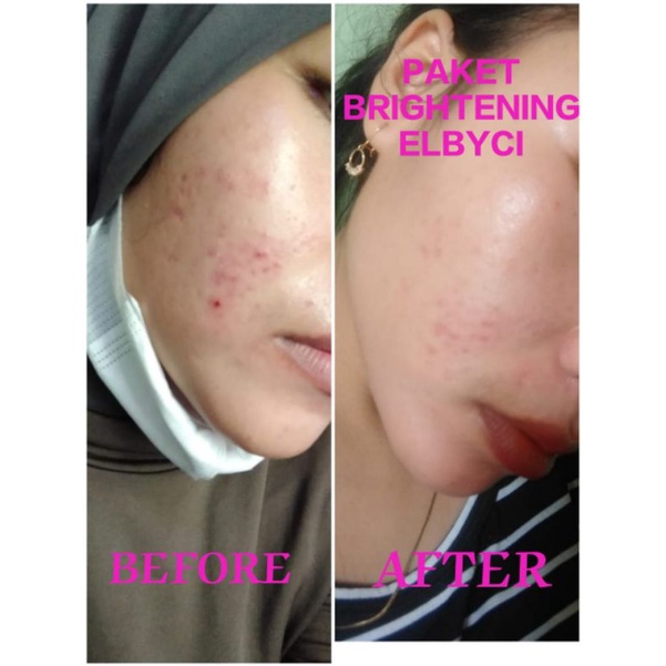 Elbyci skincare