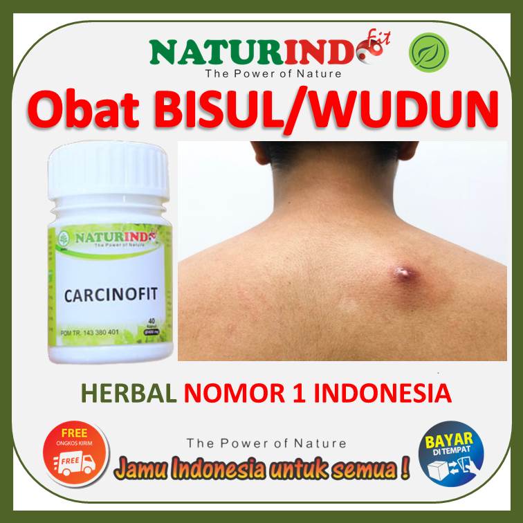 Obat bisul dipantat ampuh obat bisul dikelamin anak dewasa udun obat wudun bisulan herbal