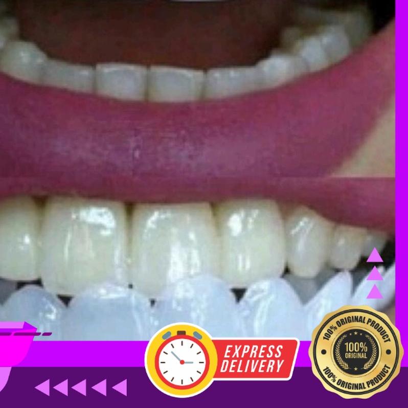 SNAP ON SMILE ORIGINAL 1 SET (ATAS & BAWAH)