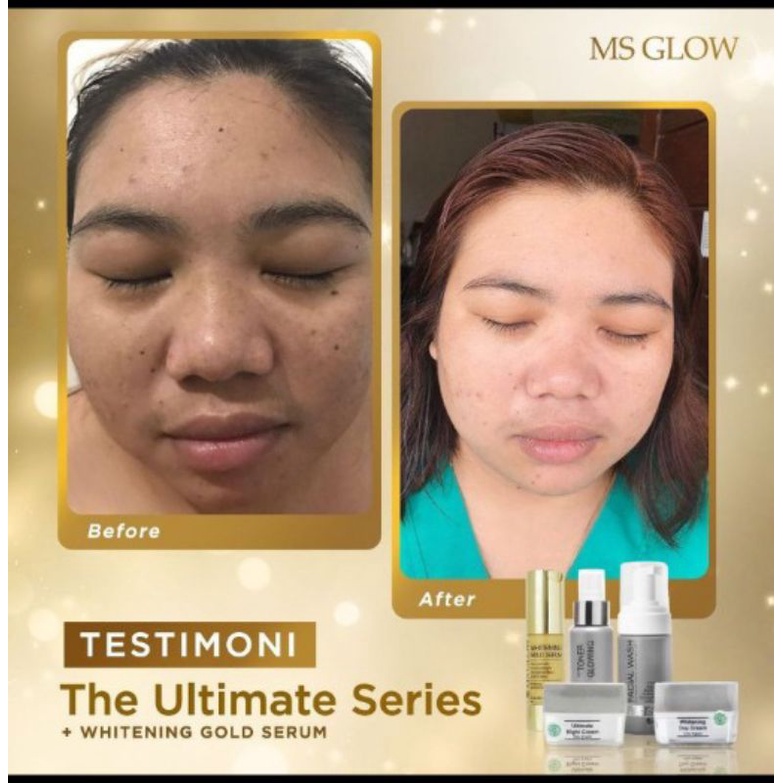 Paket Ultimate+Serum Gold whitening glowing MS GLOW