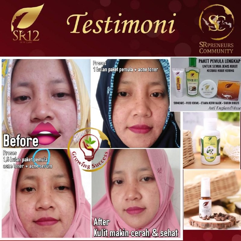 PAKET PEMULA SR12 KOMPLIT / PERAWATAN SKINCARE AMAN &amp; ALAMI / PENETRAL KULIT / PAKET PERAWATAN WAJAH