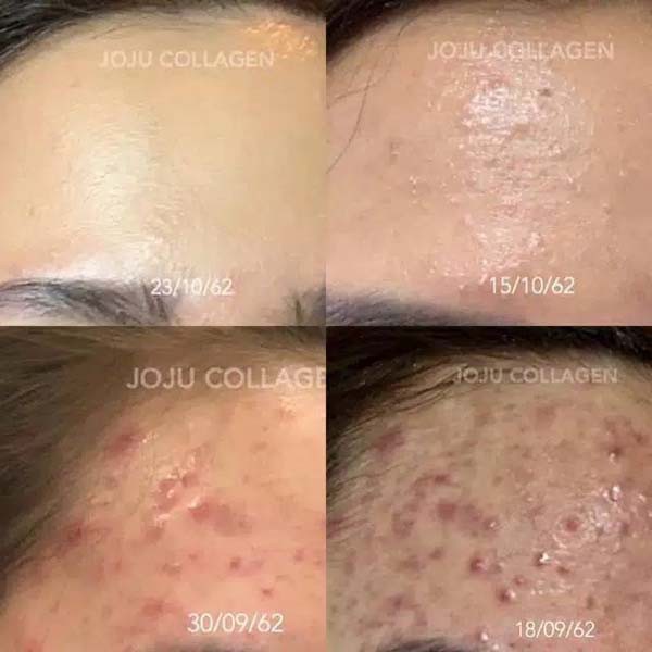 JOJU COLLAGEN update dari CL COLLAGEN  GLUTA PEMUTIH_Lynn Design