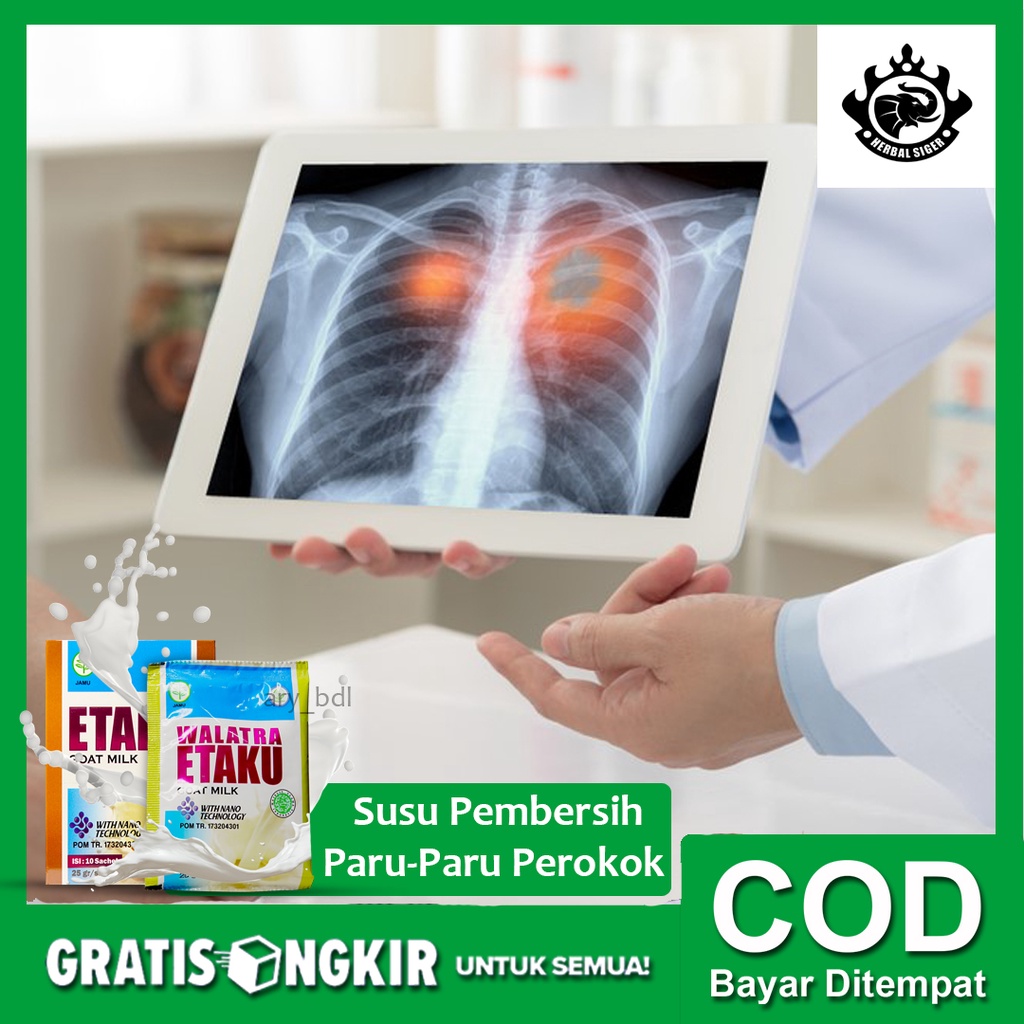 Jual Susu Herbal Pembersih Paru Paru Perokok Pembersih Paru Paru Kotor