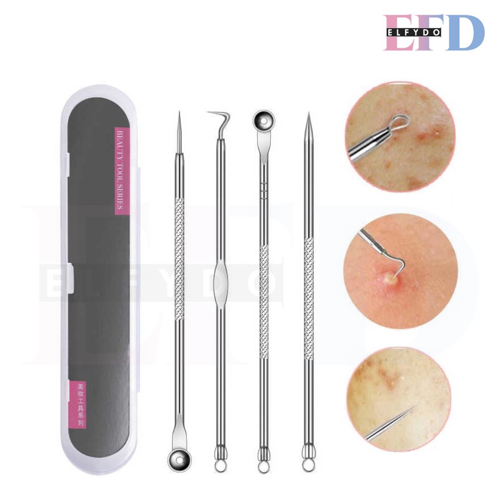 ELFYDO HL0140 Alat Pencet Jerawat Komedo Set 4 In 1 Pinset Jerawat Pembersih Blackhead