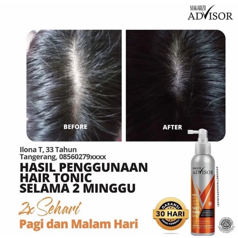 HAIR TONIC PENUMBUH RAMBUT MAKARIZO SCALP ADVISOR BESAR ORIGINAL/MAKARIZO HAIR REPAIR AND SCALP TONIC