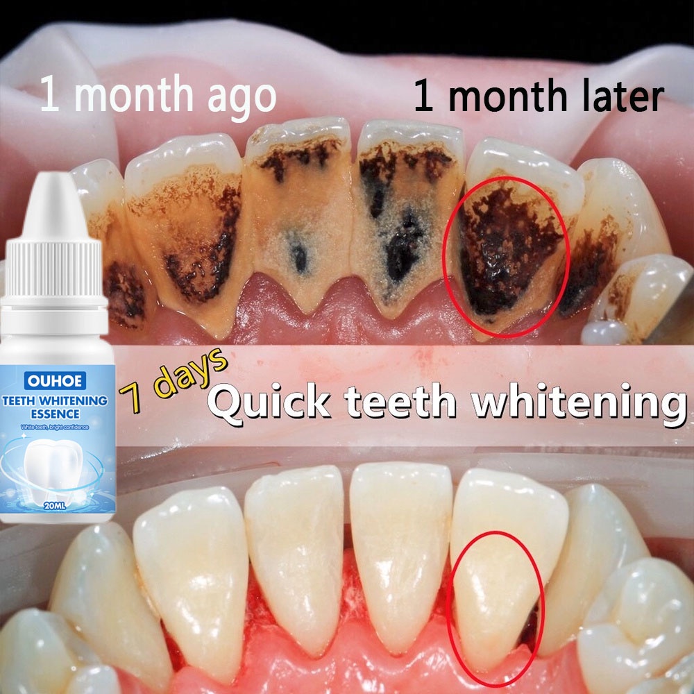 Esensi pemutih gigi Whitening teeth Cairan 10ml Menghapus Noda asap karang gigi kalkulus Kebersihan mulut Esensi pembersih Nada segar