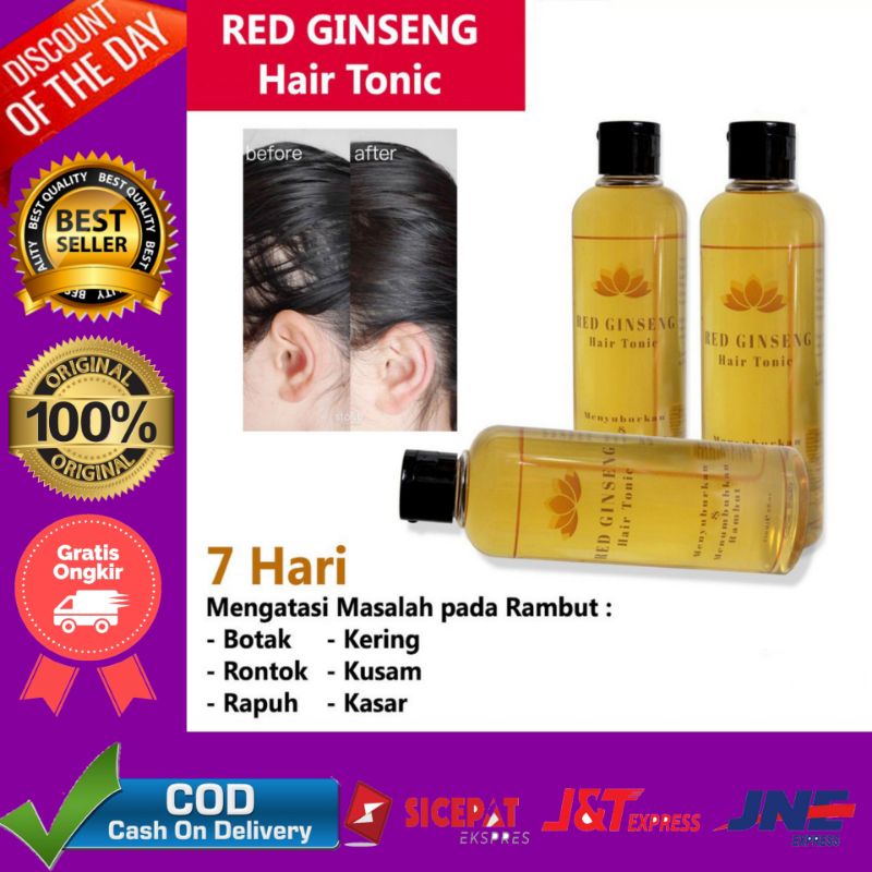 Penumbuh Rambut Botak Alami Nutrisi Rambut Ori BPOM - Penyubur Rambut Rontok dan Perawatan Rambut penumbuh rambut botak cepat alami pelebat dan penebal jenggot alis bulu mata PENUMBUH RAMBUT BOTAK PENUMBUH BREWOK PENUMBUH ALIS CEPAT OBAT KUAT PRIA