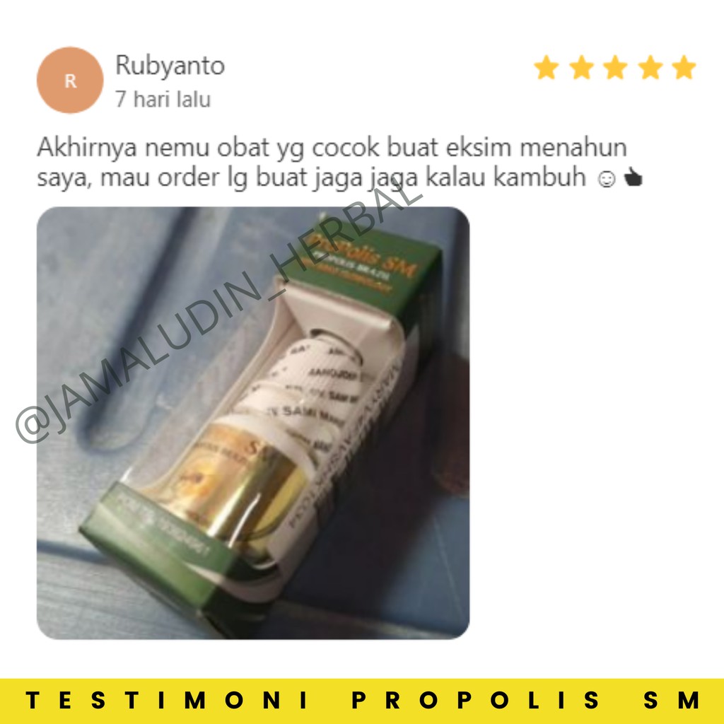 Obat Eksim Kering Basah Kering  Gatal Gatal Jamur Kulit Kepala Salep Eksim Scabies Obat Gatal Kudis Kurap Kutu Air Obat Gatel Selangkangan Berjamur Aman Balita Propolis SM Brazil Original 100% Asli-1
