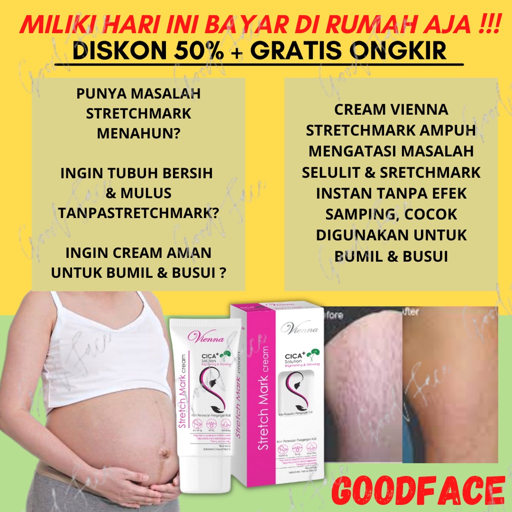 [PRIVASI] PENGHILANG STRECHMARK CREAM VIENNA STRETCH MARK PERAWATAN TUBUH