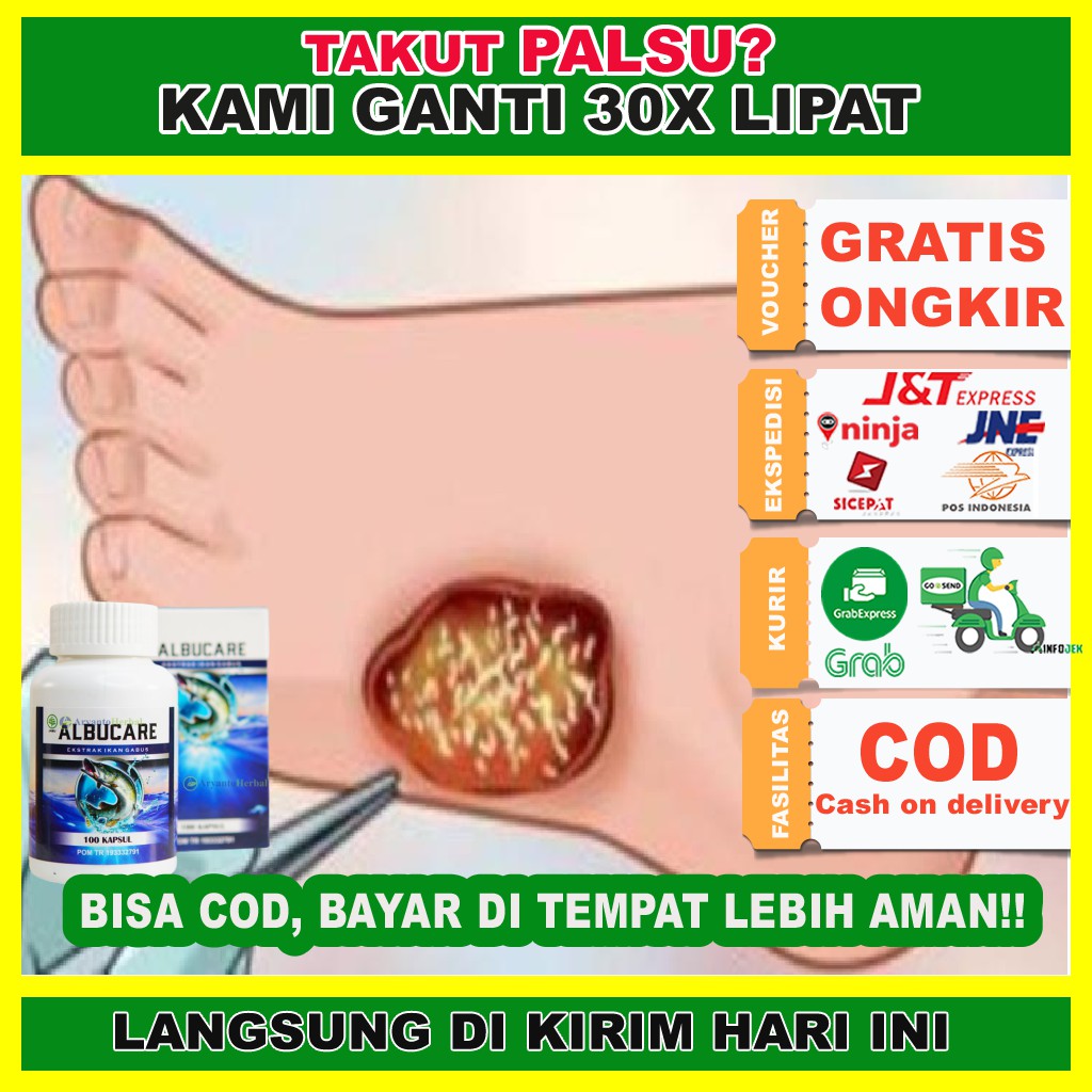 

Obat Infeksi Luka Diabetes, Obat Diabetes, Albucare Kapsul Ikan Gabus Asli 100% Murni