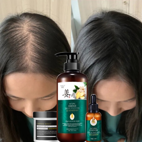 Shampo Penumbuh Rambut Cepat Serum Rambut Rontok Botak Rontok Penumbuh Rambut Perawatan Hair Care Treatment Anti Rambut Rontok