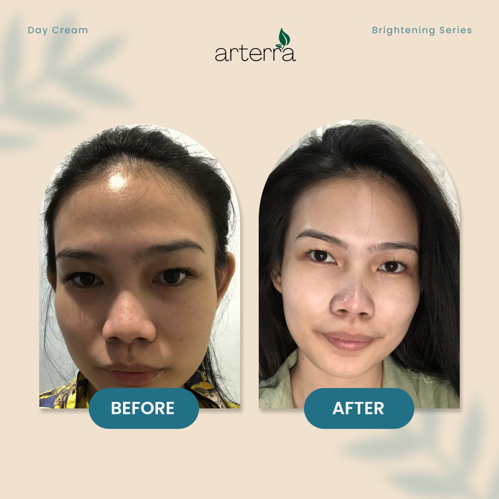 ARTERRA BRIGHTENING DAY CREAM ANTI AGING | KRIM WAJAH NIACINAMIDE ALPHA ARBUTIN