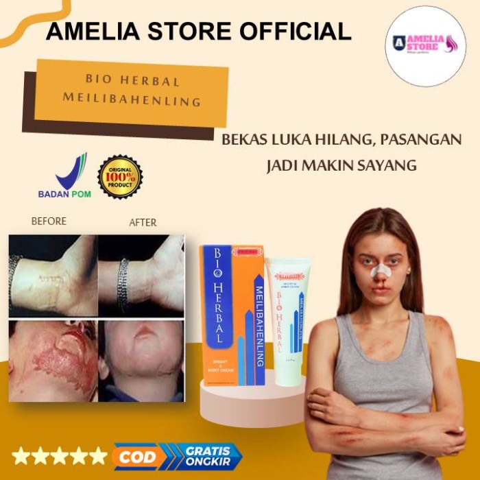 [MURAH] [ COD] Obat Salep Krim Penghilang Bekas Luka Lama Hitam Koreng dikaki Wajah