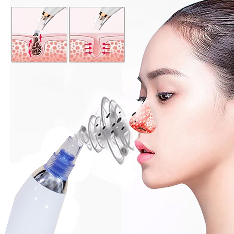 HOVELSHOP Alat Penyedot Komedo Vakum Elektrik Pembersih Jerawat Blackhead Remover