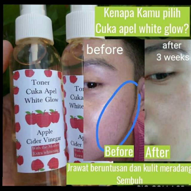 Cuka Apel White Glow Indonesia