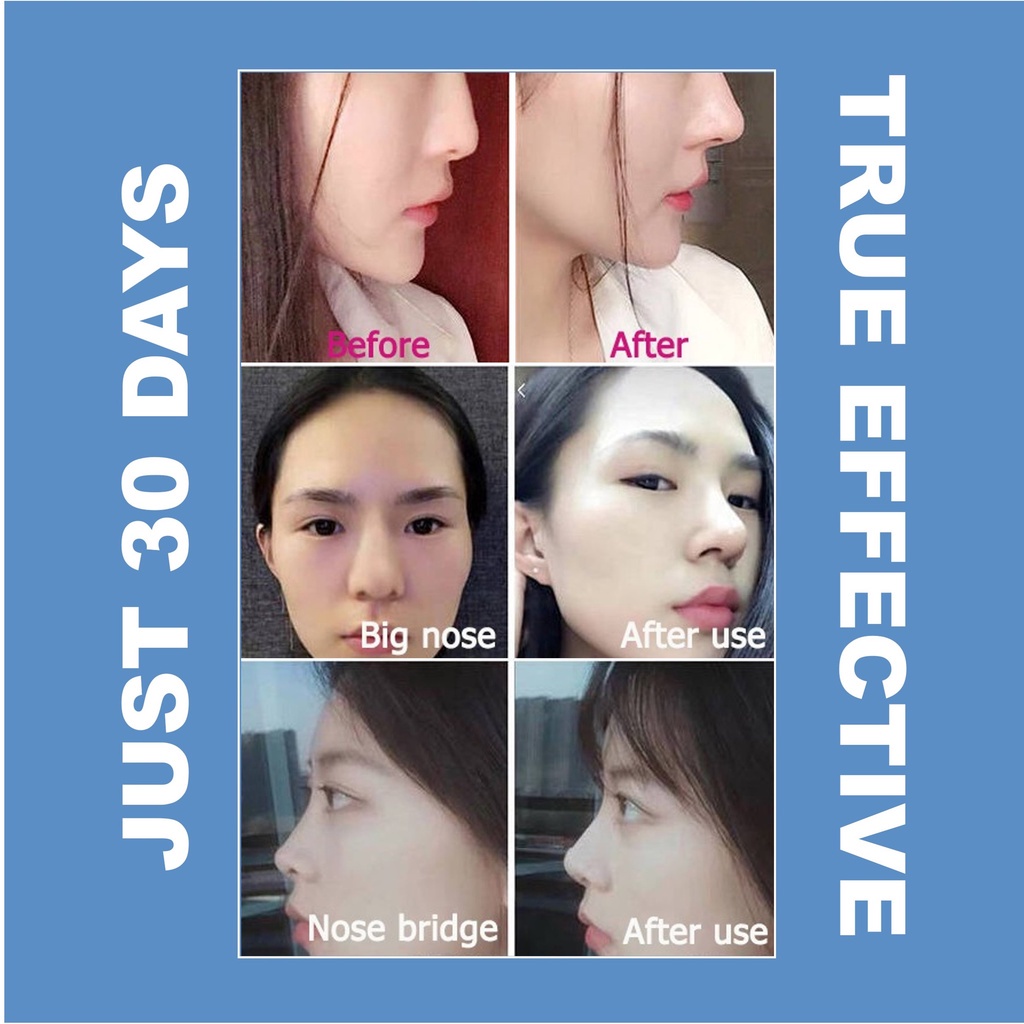 Nose lift up essential oil serum pemancung hidung nose up secret Minyak Pijat Pelembab Hidung lebih tiga dimensi dan alami alat pemancung hidung permanen Ting nose beautiful nose