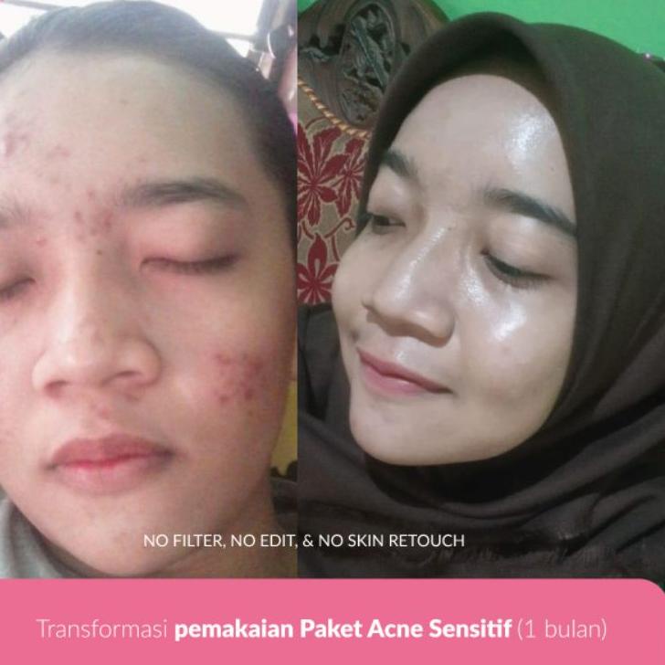 [TJM] BEAUTY GLOW BG SKINCARE  (BISA ECER) KEMASAN BARU 383