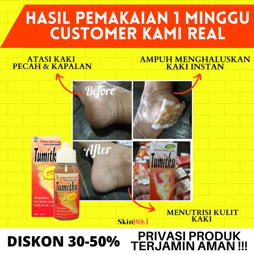 OBAT HERBAL TUMIT PECAH PECAH PENGHALUS TUMIT TUMITKU 60ML PENGHILANG KAPALAN ORIGINAL BPOM