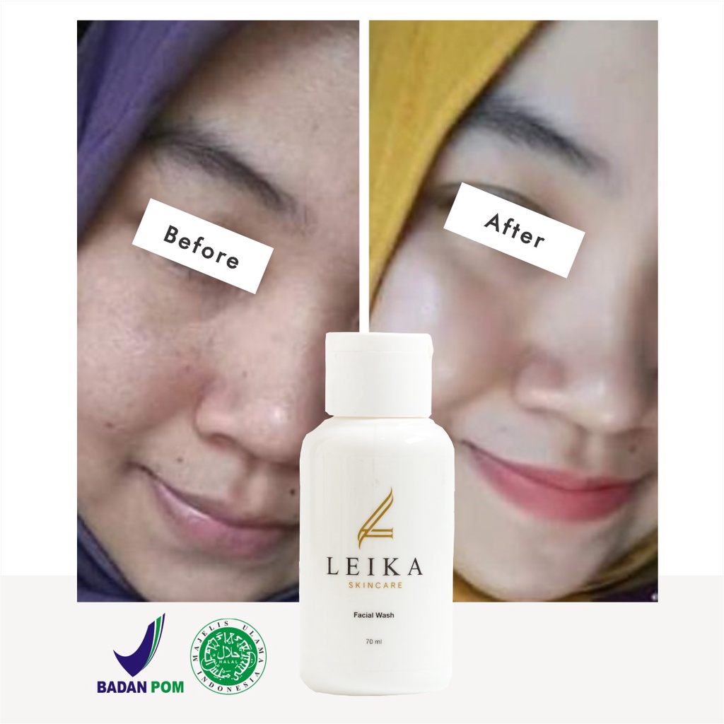 Viral! Sabun Cuci Muka Menghaluskan Wajah Ampuh 100% Asli Penghalus Wajah Bopeng Sabun Penghalus Kulit Wajah Cepat Facial Wash Leika Skincare 70ml Halal BPOM