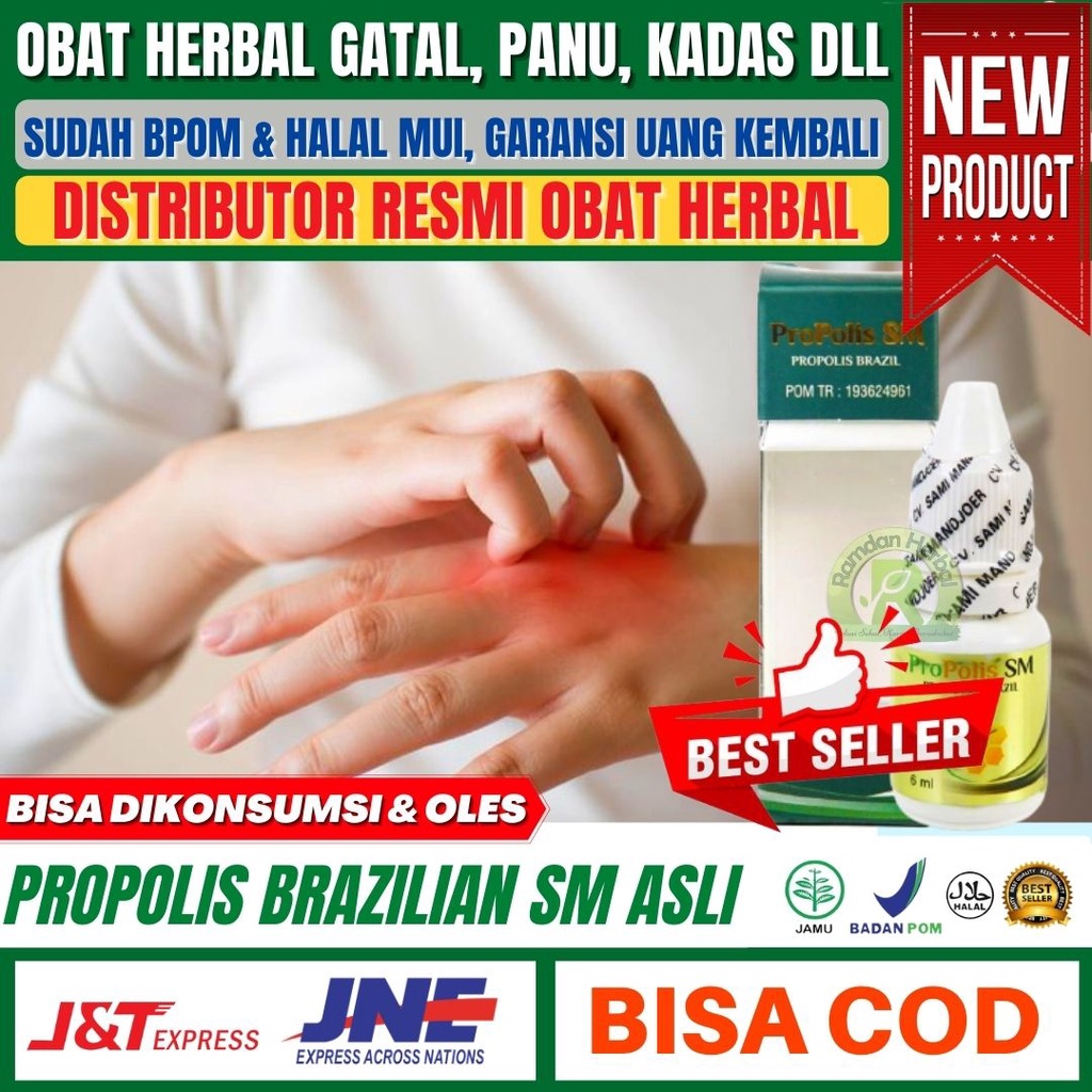 Obat Oles Untuk Gatal Gatal Jamur Panu Kurap Kutu Air Gatal Selangkangan Propolis SM 100% Original S
