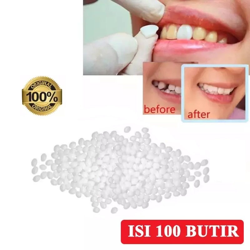 BEAUTY JAYA - [100 BUTIR]  Penutup Gigi Berlubang SUPER KUAT 100% ORIGINAL Penambal Gigi Berlubang Gigi Palsu Atas Bawah Murah