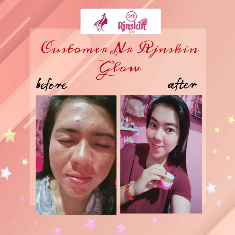 PEKET SKINCARE/PELICIN PEMUTIH WAJAH NRGLOW  PUTIH CEPAT