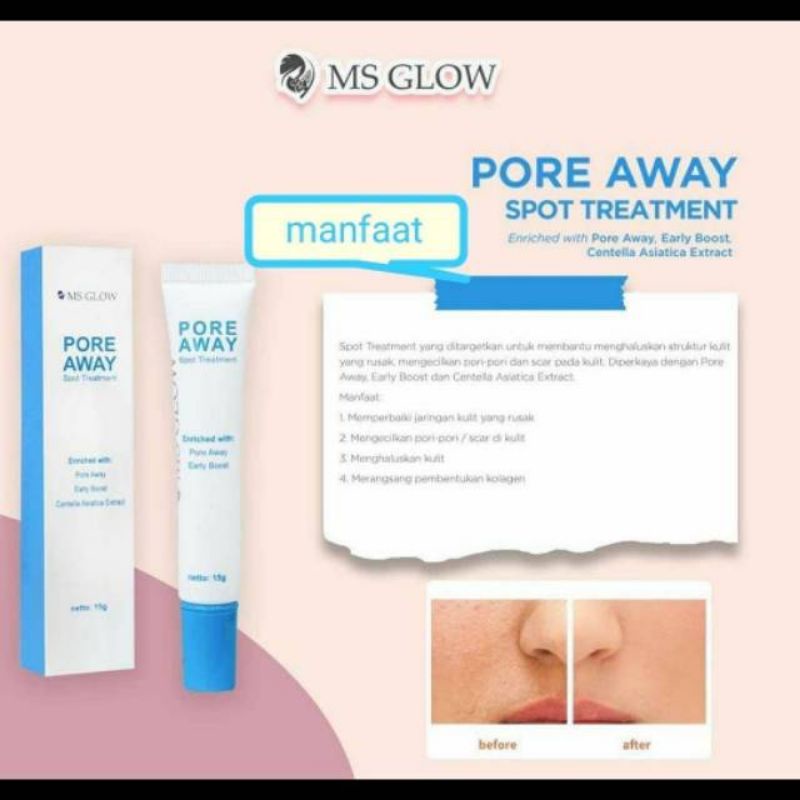 Ms GLow Spot Treatment, Pore Away, Dark Spot , Acne Spot MsGLow