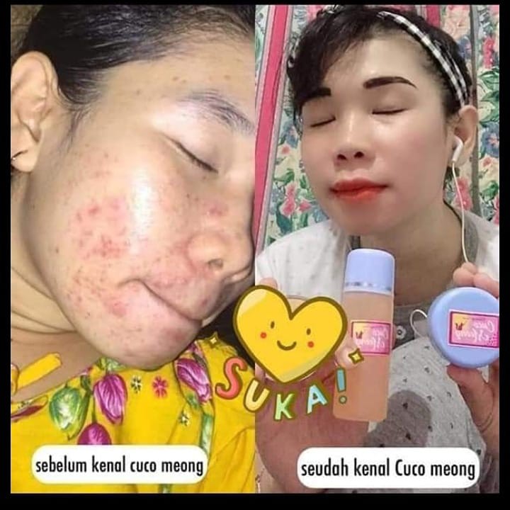 Cream Anti Mengelupas CM Cuco Meong