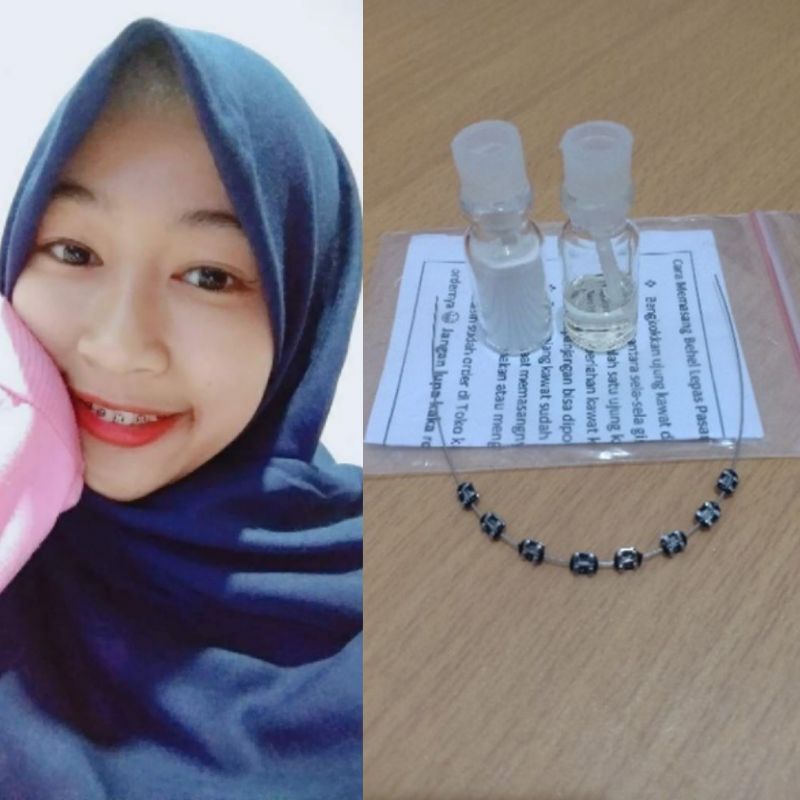 PROMO GOKIL REAL PICT BEHEL GIGI BEHEL FASHION LEPAS PASANG WARNA HITAM FREE LEM & PANDUAN PEMASANGA