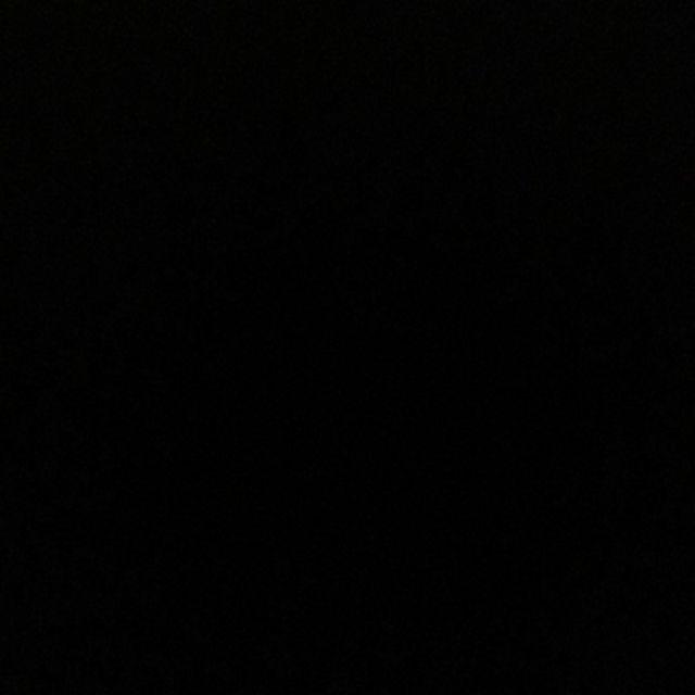 [bayar Di Tempat]telur Livecity 8 / 10 / 12inci Bahan Stainless Steel