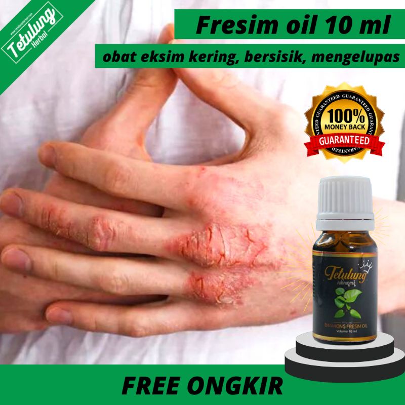 Tetulung Binahong Oil Obat Eksim Kulit Ampuh - Obat Eksim Kering Menahun - Obat Eksim Kering Kulit B