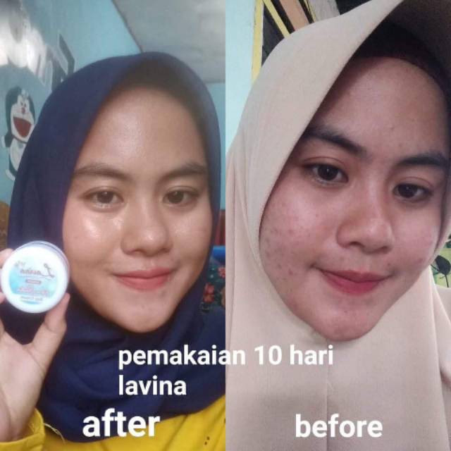 Lavina#skincare