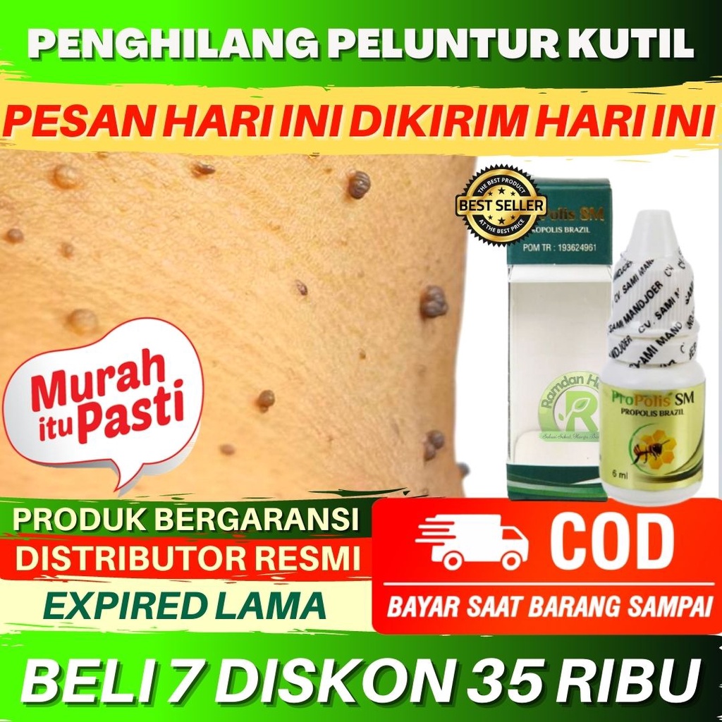 OBAT KUTIL LEHER Penghilang Kutil Di Leher Perontok Kutil Di Leher Papiloma Skin Tag Di Leher Propol