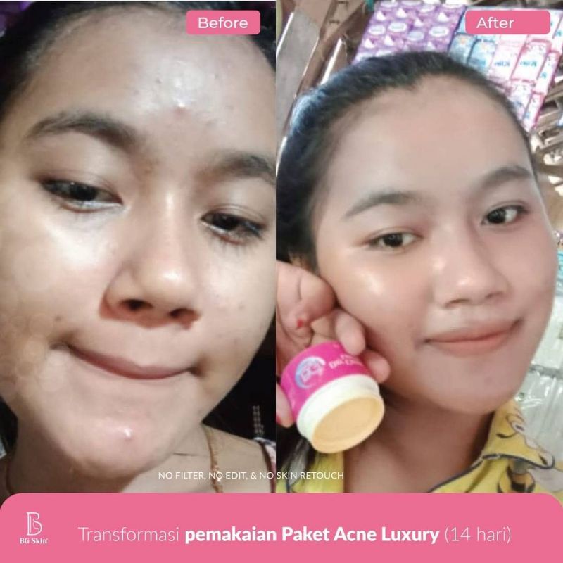 BEAUTY GLOW SKINCARE
