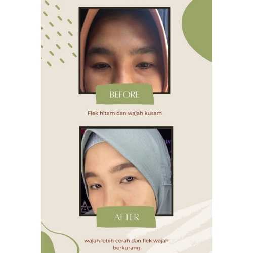 Cream Reglow dr shindy Penghilang Flek BPOM Perawatan Kecantikan Pelembab Pencerah Wajah Kusam Skincare Glowing Penghilang Bekas Jerawat Bruntusan Komedo Milia Krim Pemutih Wajah Re Glow Reg GLow Rglow Offcial Store