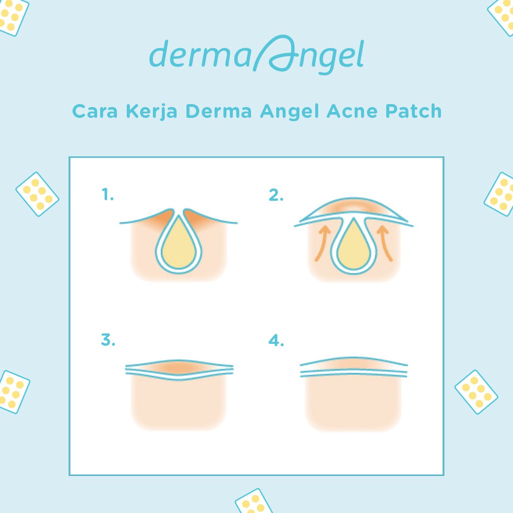 DERMA ANGEL ACNE PATCH