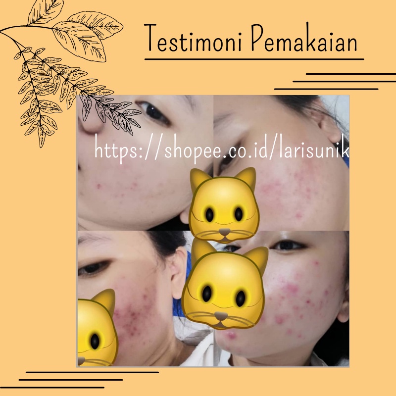 Serum Bopeng Wajah Penghilang Bekas Jerawat Flex Hitam Bintik Hitam Bruntusan Stretch Mark Acne Scars TAMANU OIL 5ml Falabell BPOM Oil