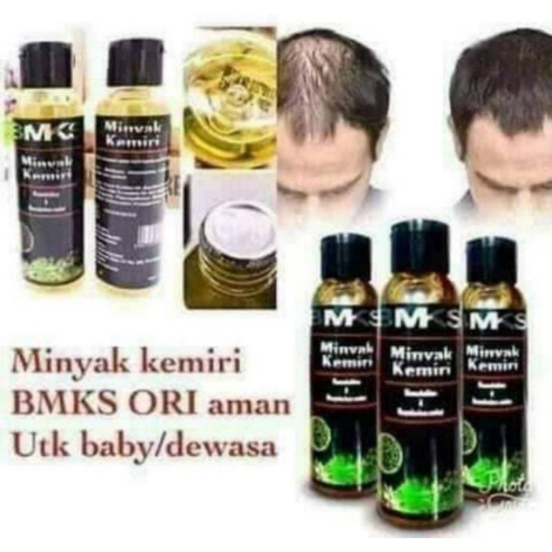 Penumbuh Rambut Botak Rambut tipis BMKS