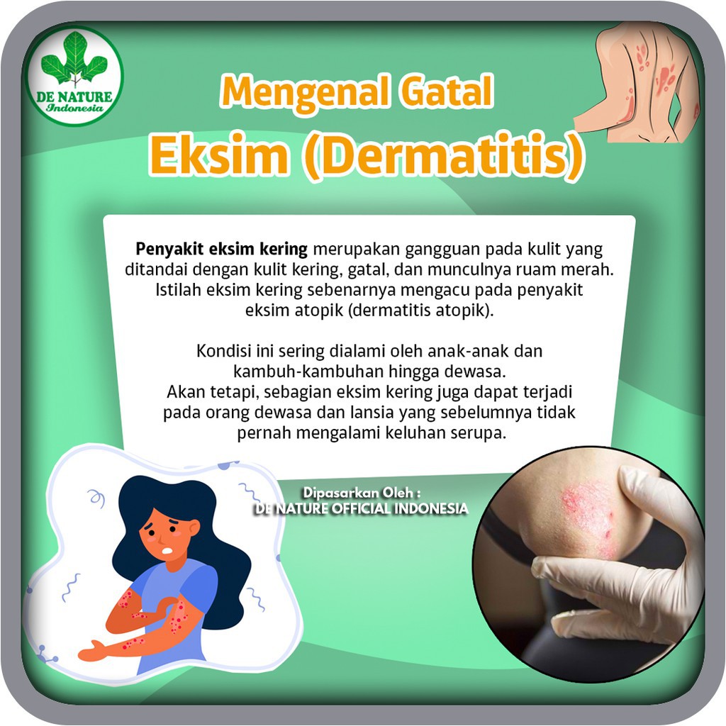 Obat Herbal Exim/Eksim Basah/ Eksim Kering Kadas Kudis Asli Ampuh Dan Tanpa Efek Samping DeNature-4