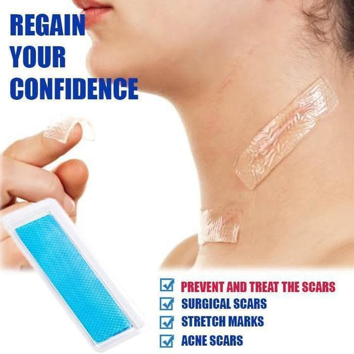 OBAT PENGHILANG LUKA SCAR REMOVAL SILICONE PATCH TRETCH MARK