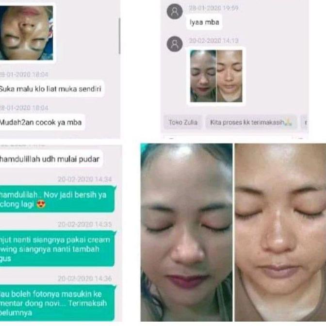 ☋ Flek dr Liz / Lis night Cream / Liz night whitening / saleb flek Lis skincare ℮