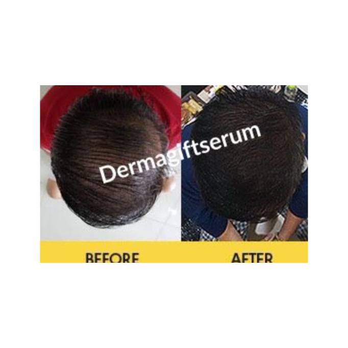 Perawatan Tubuh - Paket Dermagift - Gold