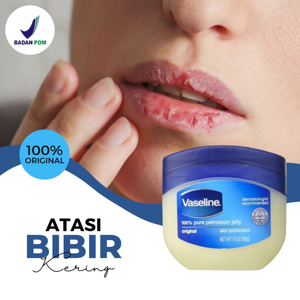 Vaseline Petroleum Jelly Original Pelembab Kulit Sensitif Kering Bersisik Busik Pecah Pecah Gatel Ga