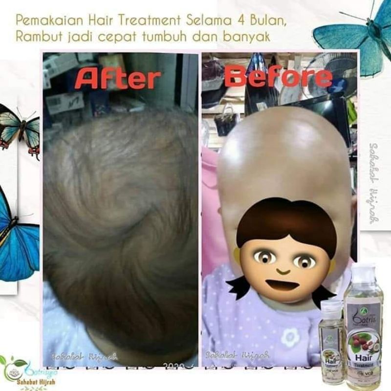 Baby hair treatment/ Penumbuh rambut anak/melebatkan rambut/menghitamkan rambut bahan alami bpom