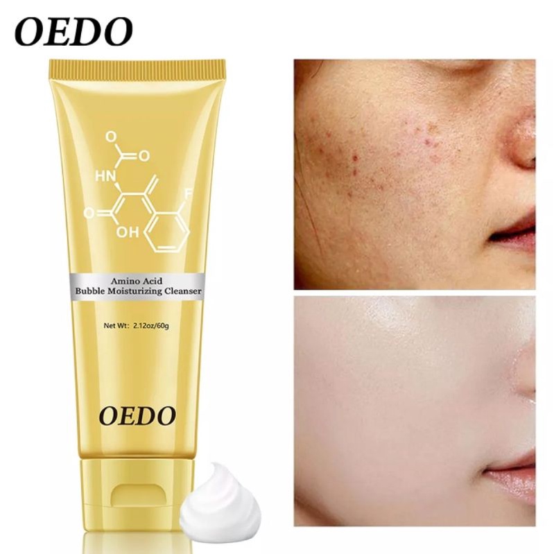 OEDO AMINO ACID BUBBLE MOISTURIZING FACIAL FOAM CLEANSER FACE WASHING PRODUCT FACE SKIN CARE ANTI AGING